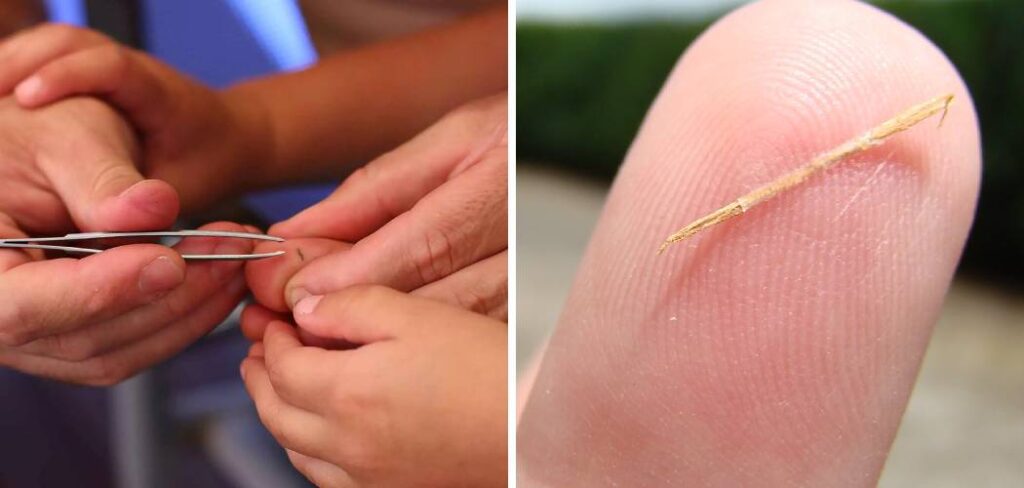 How to Remove Wood Splinter