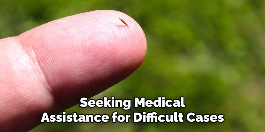 Seeking Medical Assistance for Difficult Cases